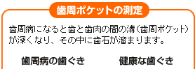 �����|�P�b�g�̑���