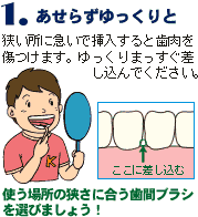 1 �����炸��������