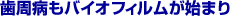 �����a���o�C�I�t�B�������n�܂�