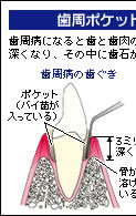 �����|�P�b�g�̑��茟��