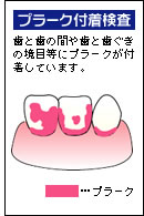 �v���[�N�t������